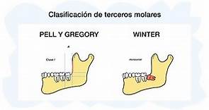 PELL Y GREGORY - WINTER: Clasificación terceros molares 🦷✅