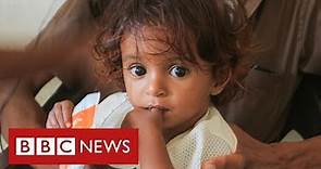 Yemen facing world’s “worst famine in decades” - BBC News