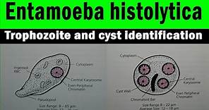 Entamoeba histolytica trophozoite and cyst | microscopic view ((with identification features)