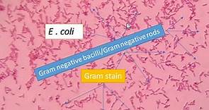 E. coli Gram stain: Introduction, Principle, Procedure and Result Interpret