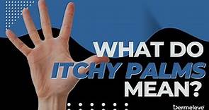 What Do Itchy Palms Mean? - Dermeleve®