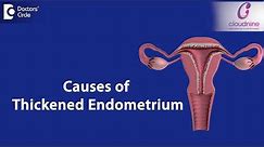 What causes Endometrial thickness? - Dr.Smitha Sha of Cloudnine Hospitals | Doctors' Circle