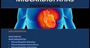 Miocardiopatías - Fisiopatología