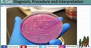 E Coli (Escherichia coli) in Microbiology: Purpose, Procedures, Interpretation