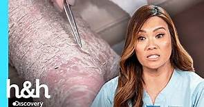 "¡Esto es un misterio para mi!" | Dra. Sandra Lee: Especialista en piel | Discovery H&H