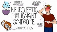 Neuroleptic Malignant Syndrome (NMS) Explained