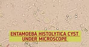 Entamoeba Histolytica (E.H)cyst under microscope.Stool Microscopy.Stool Parasites under microscope.