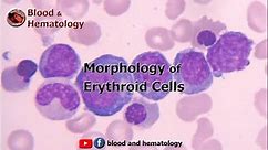Morphology of Erythroid Cells