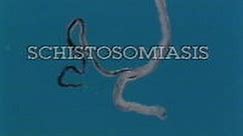 Schistosomiasis Pt 1 of 3 (1990)