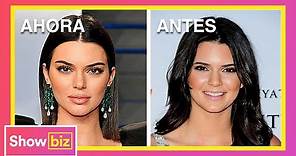La transformación de Kendall Jenner, antes y después | Showbiz