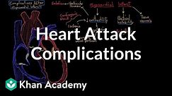Complications after a heart attack (myocardial infarction) | NCLEX-RN | Khan Academy