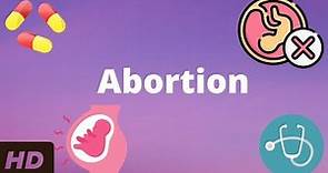 Abortion: Everything You Need To Know