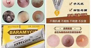 日本🇯🇵皮膚醫學博士強力推薦 去疣神膏