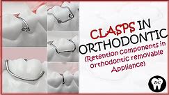 CLASPS IN ORTHODONTICS (Part-1) || RETENTIVE COMPONENT IN REMOVABLE APPLIANCES || BY DENTAL CAFE