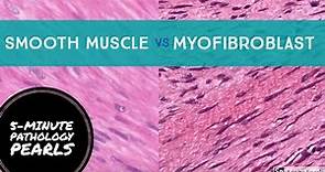 Myofibroblasts vs Smooth Muscle Made Easy: 5-Minute Pathology Pearls
