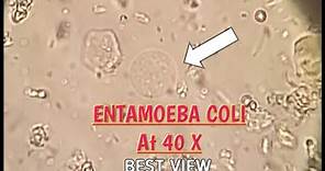Entamoeba Coli best view in stool microscopy at 40X.E.Coli in stool microscopy.Parasites in stool.