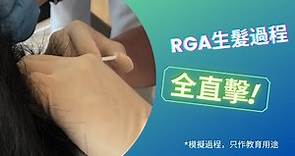 【RGA生髮2022】過程全直擊！RGA生髮原理，RGA生髮價錢