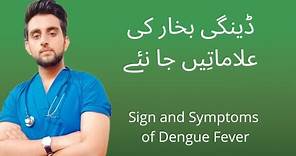 Sign and symptoms of Dengue fever || in Urdu and Hindi
