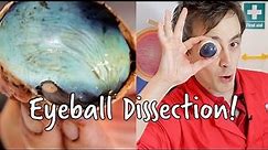 What's inside an eyeball? | Eyeball Dissection | We The Curious