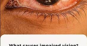 What is a visual disturbance? | What causes impaired vision? | Apollo Hospitals