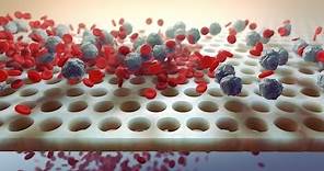 Medical Device and Pharmaceutical Drug Animations | Nucleus Medical Media