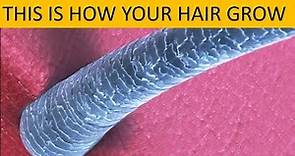 How Your Hair Grows ? Hair Cycle and Hair Growth Factors #kids #science #dermatology