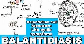 Balantidiasis | Balantidium coli, Structure, Life cycle, Symptoms, Medication | Bio science
