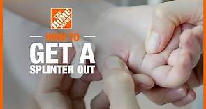 How to Get a Splinter Out | The Home Depot