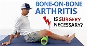 Bone on Bone (Osteoarthritis) Knee Pain Exercises & Treatment Options