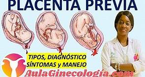 PLACENTA PREVIA: CLASIFICACIÓN, DIAGNÓSTICO, 🩸SÍNTOMAS🩸, MANEJO... - Ginecología y Obstetricia -