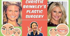 Doctor Reacts to Christie Brinkley’s Plastic Surgery - Dr. Anthony Youn