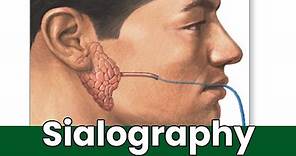 What Is Sialography: Overview, Uses, And The Procedure? How Is Sialography Done?