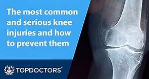 The most common and serious knee injuries and how to prevent them