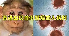 香港出现首例猴痘输入病例 科普：哪些人群最容易感染
