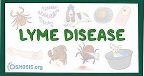 Lyme disease - causes, symptoms, diagnosis, treatment, pathology