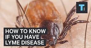 How to know if you have Lyme disease