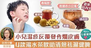 【對抗濕疹】小兒濕疹反覆發作爛皮膚　4款湯水茶飲助清熱祛濕健脾 - 香港經濟日報 - TOPick - 親子 - 兒童健康