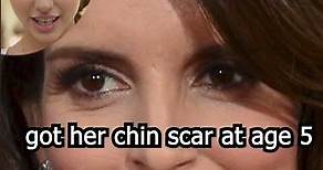 The Mysterious Origin of Tina Fey's Iconic Chin Scar