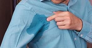 How to manage excessive sweating