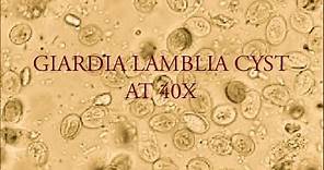 Giardia lamblia cyst under microscope at 40X.