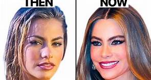 Sofia Vergara NEW Face | Plastic Surgery Analysis