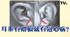 耳垂有褶痕就有心脏病吗？| CCTV科教