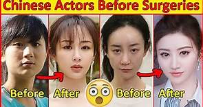 Chinese Actors Before and After Plastic Surgeries 😮 , Incredible Changes, Chinese Drama