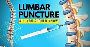 Lumbar Puncture: Everything You Need to Know