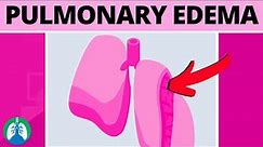 Pulmonary Edema (Medical Definition) | Quick Explainer Video