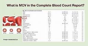 What is MCV? Why my MCV value is abnormal?