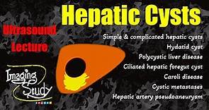 Hepatic Cysts || Cystic Lesions || Ultrasound Lecture || Imaging Study