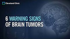 6 Warning Signs of Brain Tumors
