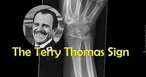 The Terry Thomas Sign