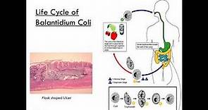 Balantidium Coli (Class Ciliate) Parasitology